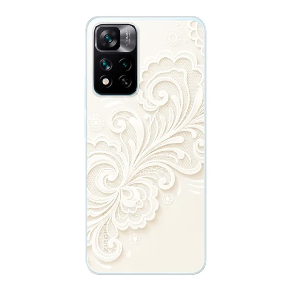 Lace Case Design