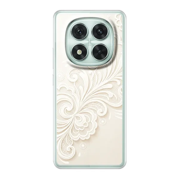 Lace Case Design